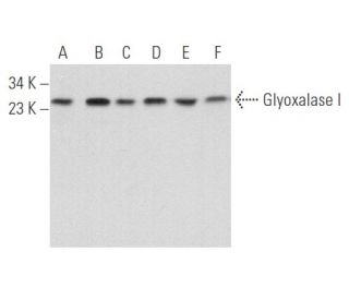 Glyoxalase I Antibody (GloIa) - Western Blotting - Image 357702
