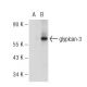 glypican-3 Antibody (1G12) - Western Blotting - Image 109737