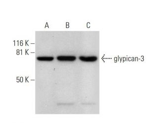 glypican-3 Antibody (F-3) - Western Blotting - Image 289590 