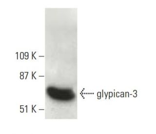 glypican-3 Antibody (F-3) - Western Blotting - Image 396535