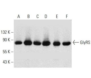 GlyRS Antibody (F-5) - Western Blotting - Image 385178 