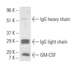 GM-CSF Antibody (1D11) - Western Blotting - Image 10106