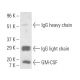 GM-CSF Antibody (1D11) - Western Blotting - Image 10106