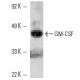 GM-CSF Antibody (4G9) - Western Blotting - Image 10739
