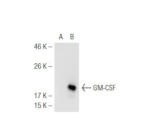 GM-CSF Antibody (B6-2-hGMCSF) - Western Blotting - Image 54847 
