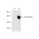 GM-CSFRα Antibody (8G6 BOT) - Western Blotting - Image 62580 