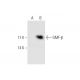 GMF-β Antibody (SP-61) - Western Blotting - Image 68593