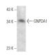 GNPDA1 Antibody (237CT2.5.2) - Western Blotting - Image 374560