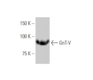 GnT-V Antibody (3E9) - Western Blotting - Image 347562Each CRISPR/Cas9 Knockout (KO) Plasmid product consists of a pool of 3 plasmids designed to ensure identification and cleavage of a specific gene for maximum knockout efficiency. Each plasmid encodes a unique 20 nt sequence derived from the GeCKO (v2) library.