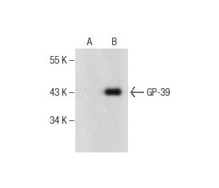 GP-39 Antibody (D-6) - Western Blotting - Image 160688