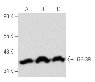 GP-39 Antibody (E-10) - Western Blotting - Image 356717 