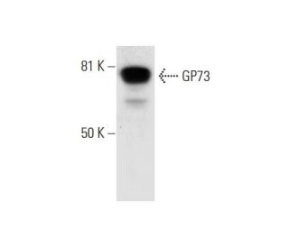 GP73 Antibody (F-12) - Western Blotting - Image 295802 