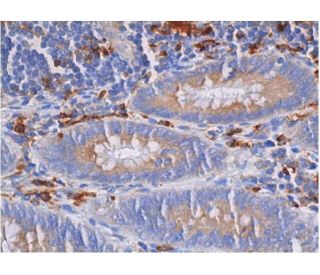 gp91phox/CYBB/NOX2 Antibody (NL7) - Immunohistochemistry - Image 353014 