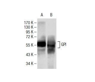 GPI Antibody (1B7D7) - Western Blotting - Image 137473 