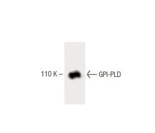 GPI-PLD Antibody (15) - Western Blotting - Image 60186 