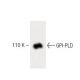 GPI-PLD Antibody (15) - Western Blotting - Image 60186 