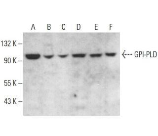 GPI-PLD Antibody (D-10) - Western Blotting - Image 376914 