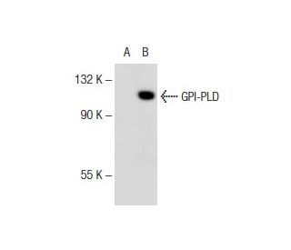 GPI-PLD Antibody (E-5) - Western Blotting - Image 145669 
