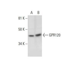 GPR120 Antibody (H-10) - Western Blotting - Image 289640 