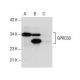 GPRC5D Antibody (E-7) - Western Blotting - Image 157399