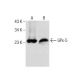 Glutathione Peroxidase 5/GPX5 Antibody (D-2) - Western Blotting - Image 160868