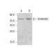 GRAMD3 Antibody (G-10) - Western Blotting - Image 384769