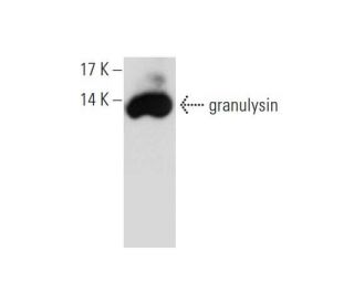 granulysin Antibody (F-9) - Western Blotting - Image 129490Each CRISPR/Cas9 Knockout (KO) Plasmid product consists of a pool of 3 plasmids designed to ensure identification and cleavage of a specific gene for maximum knockout efficiency. Each plasmid encodes a unique 20 nt sequence derived from the GeCKO (v2) library.