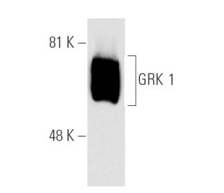 GRK 1 Antibody (G-8) - Western Blotting - Image 2200