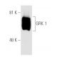 GRK 1 Antibody (G-8) - Western Blotting - Image 2200