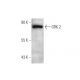 GRK 2 Antibody (E-7) - Western Blotting - Image 350820 