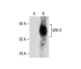 GRK 6 Antibody (D-10) - Western Blotting - Image 285050