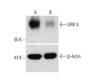 GRK 6 CRISPR/Cas9 KO Plasmid (h): sc-402061. Western blot analysis... 