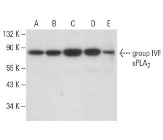 group IVF sPLA<sub>2</sub> Antibody (C-6) - Western Blotting - Image 308169 
