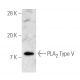 group V PLA2 Antibody (3G1) - Western Blotting - Image 3789 