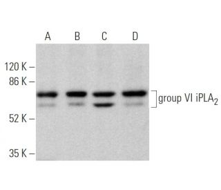 group VI iPLA<sub>2</sub> Antibody (E-8) - Western Blotting - Image 373595Each CRISPR/Cas9 Knockout (KO) Plasmid product consists of a pool of 3 plasmids designed to ensure identification and cleavage of a specific gene for maximum knockout efficiency. Each plasmid encodes a unique 20 nt sequence derived from the GeCKO (v2) library.