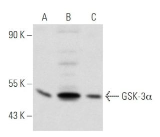 GSK-3&alpha; Antibody (10C1) - Western Blotting - Image 31741