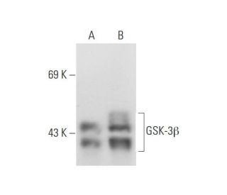 GSK3 beta Antibody (1V001) - Western Blotting - Image 80907 