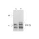 GSK3 beta Antibody (1V001) - Western Blotting - Image 80907 