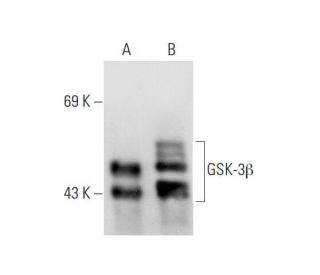 GSK3 beta Antibody (2Q274) - Western Blotting - Image 80901 
