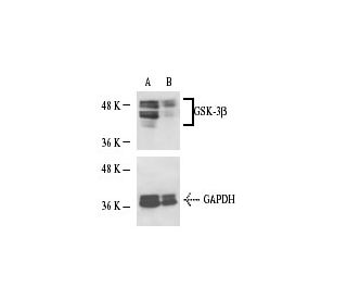 GSK-3&beta; siRNA (h): sc-35527. Western blot analysis of GSK-3&beta; expression in non-transfected control (A) and GSK-3& 