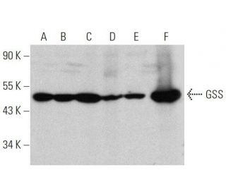 GSS Antibody (C-5) - Western Blotting - Image 359424 