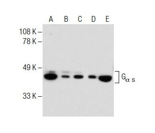 G<sub>α s</sub> Antibody (12) - Western Blotting - Image 149030