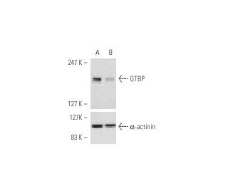 GTBP siRNA (h): sc-35528. Western blot analysis of GTBP expression in non-transfected control (A) and GTBP siRNA transfect 
