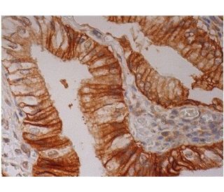 GW182 Antibody (A-8) - Immunohistochemistry - Image 286496 