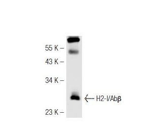 H2-I/Ab&beta; Antibody (25-9-3) - Western Blotting - Image 43006