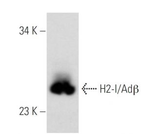 H2-I/Ab&beta; Antibody (5K40) - Western Blotting - Image 43004