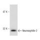 H4 Cell Lysate: sc-2408. Western blot analysis of Neurexophilin-2 expression... 