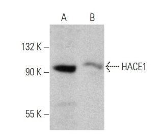 HACE1 Antibody (C-9) - Western Blotting - Image 360563 