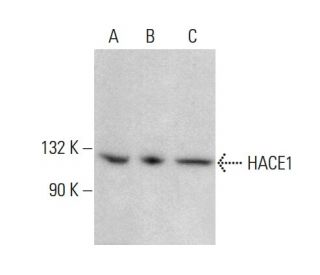 HACE1 Antibody (C-9) - Western Blotting - Image 377461Each CRISPR/Cas9 Knockout (KO) Plasmid product consists of a pool of 3 plasmids designed to ensure identification and cleavage of a specific gene for maximum knockout efficiency. Each plasmid encodes a unique 20 nt sequence derived from the GeCKO (v2) library.