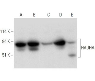 HADHA Antibody (G-9) - Western Blotting - Image 344507